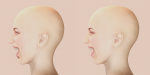 Lower Teeth Gum Fix 0.png