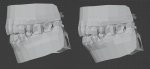 TeethLowerGumFix.jpg
