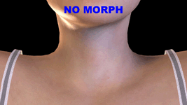 NeckTendonDetail.gif
