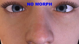 UnderEyeCrease.gif