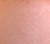 skin.jpg skin.jpg