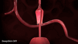 DeepSkin CUAs - Tentacles.gif