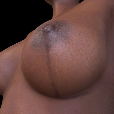 Titty Scar