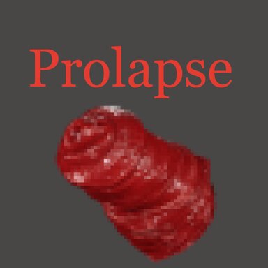Prolapse